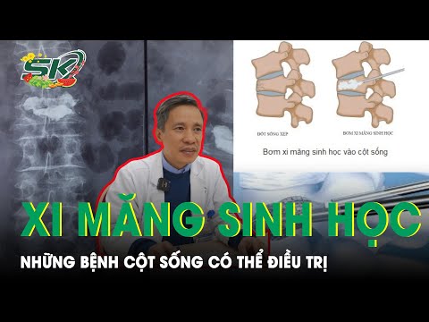 Đổ bê tông cột sống: Quy trình, Ưu điểm và Yếu tố cần lưu ý