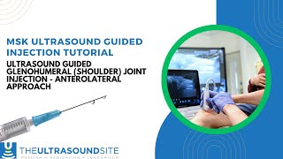 Ultrasound guided glenohumeral (shoulder) joint injection  anterolateral approach