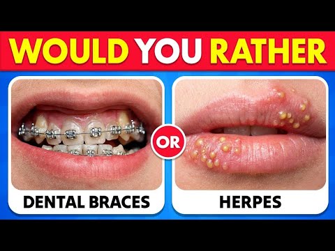 ​🔥 Would You Rather...? 😨 The 100 Most Extreme Choices You’ll EVER Face!