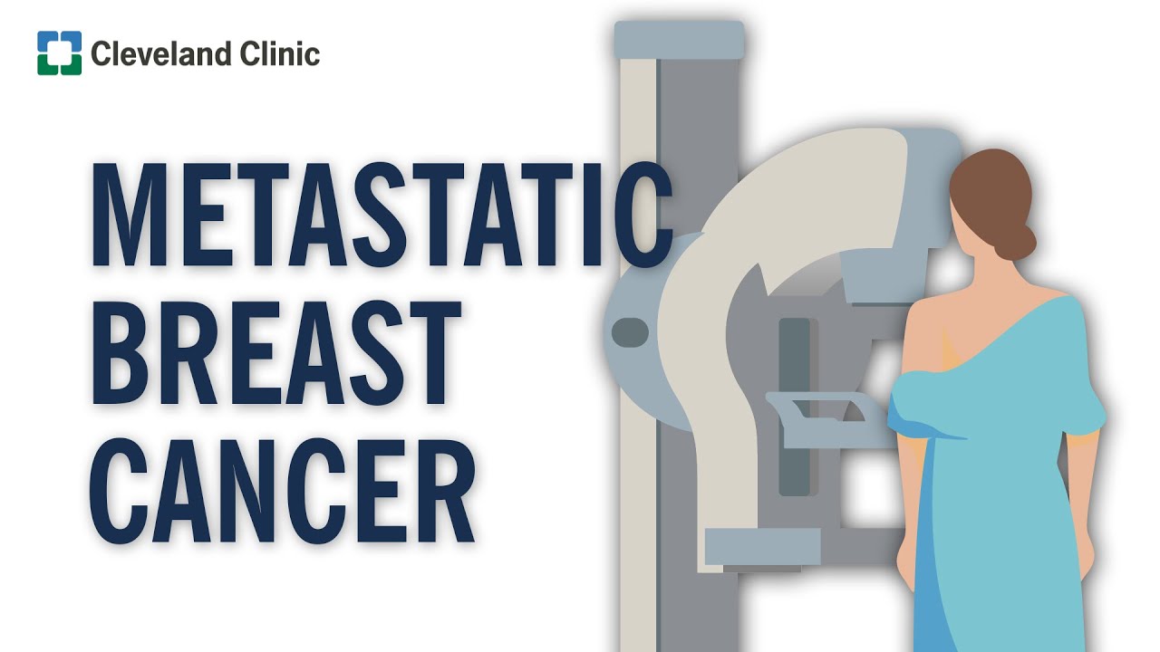 What Is Metastatic Breast Cancer Youtube