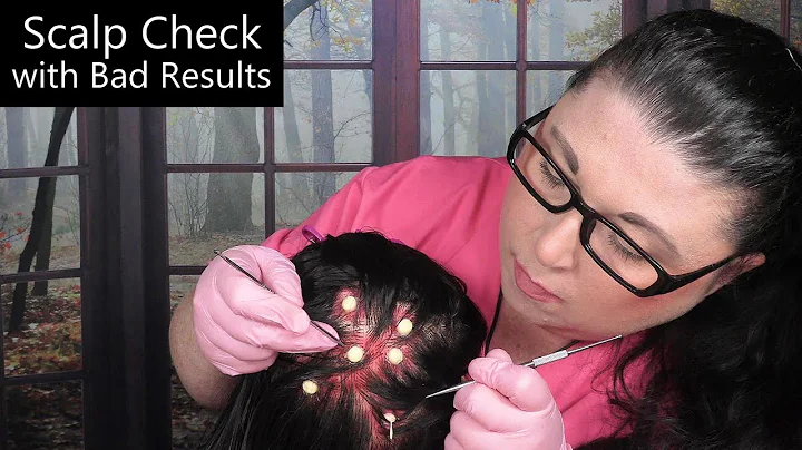 ASMR Scalp Check with Bad Results (Acne Removal, Scalp Treatment, Whispering) Medical Roleplay