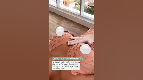 PÓS OPERATÓRIO MASTOPEXIA COM PRÓTESE DE 190 ML #pósoperatório