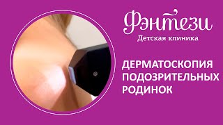 👩‍⚕️ ​Дерматоскопия подозрительных родинок