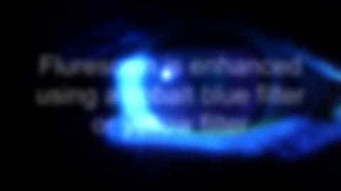 Normal tearfilm 1.mp4