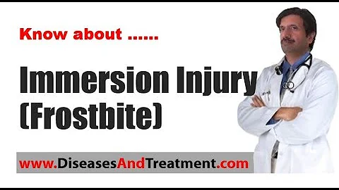 Immersion Injury (Frostbite) : Causes, Diagnosis, Symptoms, Treatment, Prognosis