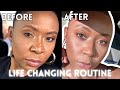 My night time skincare routine OILY ACNE skin | COMPLETELY CHANGED MY LIFE!!!