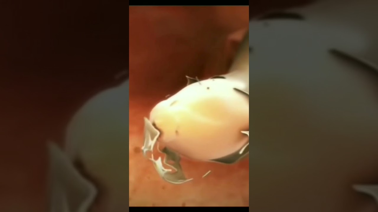 How do filarial worms enter the body? # shorts #neet #biology #amazing