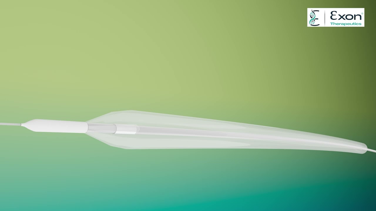 SLEEK: Non-Compliant Balloon Catheter.