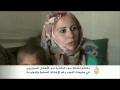 سوء التغذية لدى الأطفال السوريين