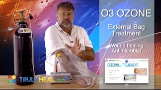 External treatment with ozone O3. Ozone bagging for wound healing. ...