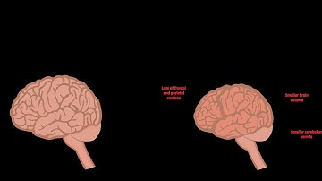 "Unlocking the ADHD Brain: Transform Chaos into Creative Power"