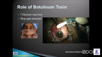Dr Muralidhar - Management of Paralytic Strabismus - AIOS ARC Neuro Ophthalmology