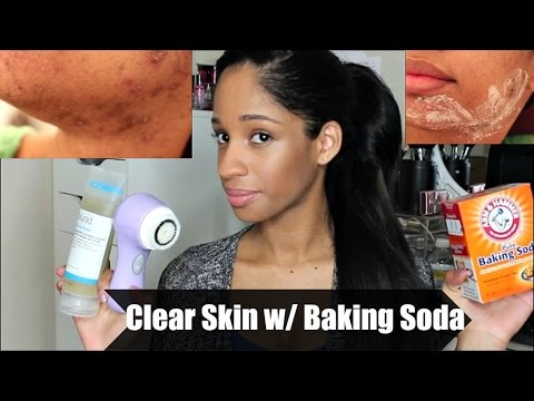 LAST UPDATE~CLEAR SKIN w/ BAKING SODA | ACNE CARE ROUTINE