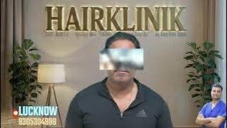 हेयर ट्रांसप्लांट करा के जवानी वापस आ गयी  Hair Transplant Result | Lucknow #hairklinik