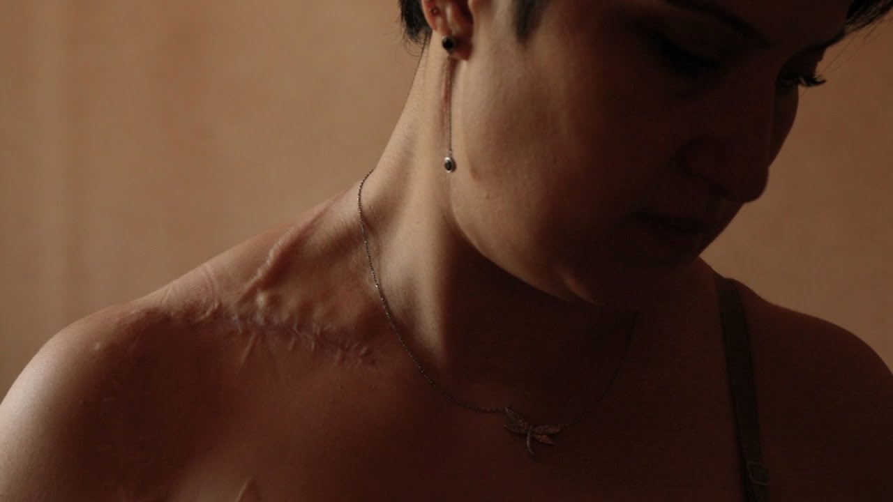 Ողջ եմ մնացել, բայց հետևանքները՝ մարմնումս. Թագուհին