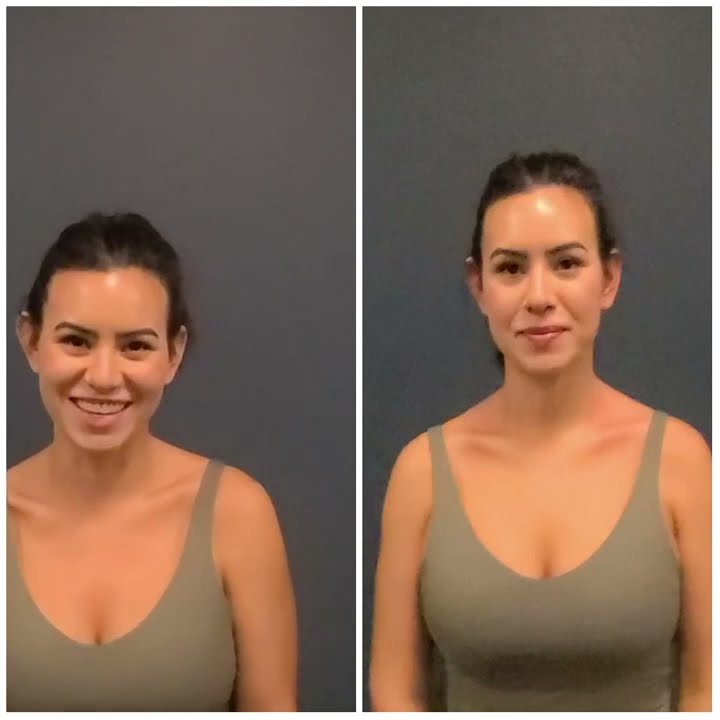 Client testimonial — Natasha, 4 weeks of neck pain rated 7/10