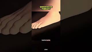 Shockwave Therapy Explained (3D Animation) #shockwavetherapy #noninvasivetreatment #physiotherapy #m