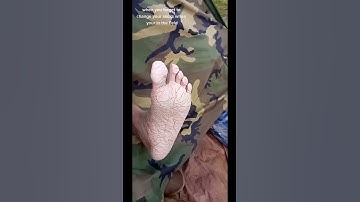 Thumbnail of Do not forget to change your socks