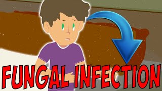 Fungal Infection Of The Skin