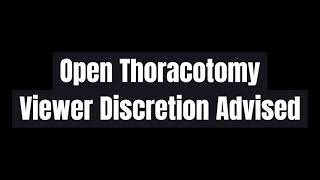Resuscitative Thoracotomy Procedure - Viewer Discretion Advised