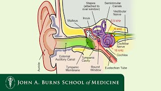 Can You Hear Me Now? Yes Indeed By Lisa Taniguchi, Aud, Ccc-A