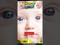 Bachon Mein Daant Nikalny Ki Nishaniyan 👶🦷