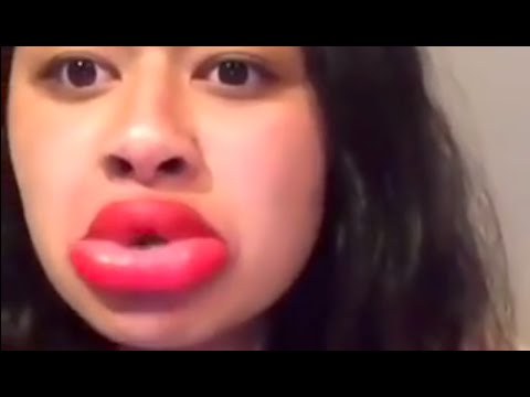 Kylie Jenner Lip Challenge Gone Wrong In Viral Video Youtube