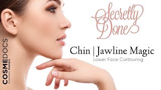 Chin Filler | Chin Augmentation | Chin Before And After
