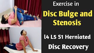 Exercise for Herniated Disc, Disc Bulge l4 L5 S1. Treatment for Slipped Disc Recovery.