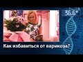 Как избавиться от варикоза? Лазерные методики.