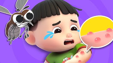 Buzz buzz buzz Mosquito Song | Kids Song