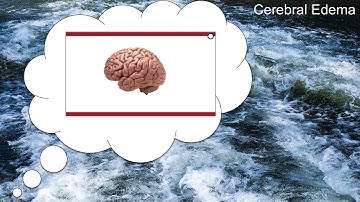 Emergency Management of Hyponatremia  (Part 2)