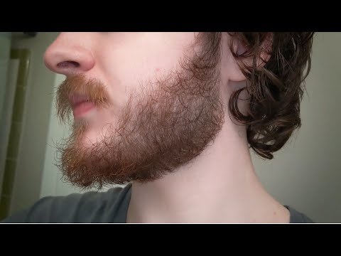 minoxidil-for-beard-growth:-day-294-//-42-week-progress