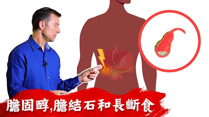 胆结石,高胆固醇,长断食中吃胆盐(胆囊配方),柏格医生 Dr Berg - 天天要闻