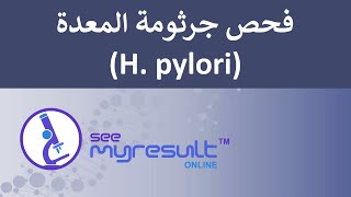 فحص جرثومة المعدة (H. pylori)