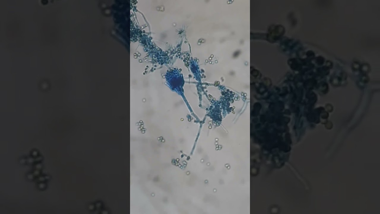 Структуры Penicillium: споры, фиалиды, конидиеносцы и мицелий 