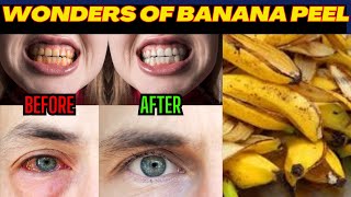 Natural Ways get  Whiter Teeth and Brighter Eyes | Banana Peels on Face DarkCircleRemedy