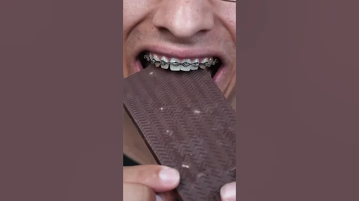 Mr. Beast Bars vs Braces - DayDayNews