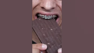 Mr. Beast Bars vs Braces