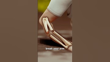 You should never ignore a broken bone 🦴