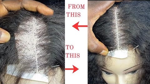 HOW TO FIX A BALD / OVERPLUCKED LACE CLOSURE IN 10 MINUTES
