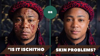 ISICHITHO SIGNS AND PREVENTIONS