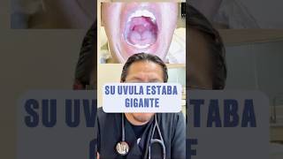 Her uvula swelled like a balloon! 😱 | Real medical case