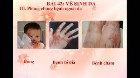 SINH HỌC 8- Vệ sinh da-THCS NGUYỄN TRÃI-TP LONG KHÁNH-ĐỒNG NAI