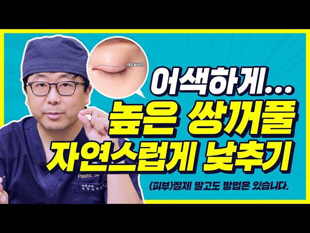 [눈재수술] 높고, 두꺼운 쌍꺼풀 자연스럽게 복구하기!?