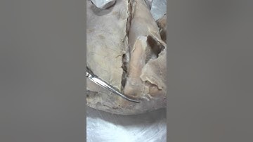 Cat Dissection Group 4-5