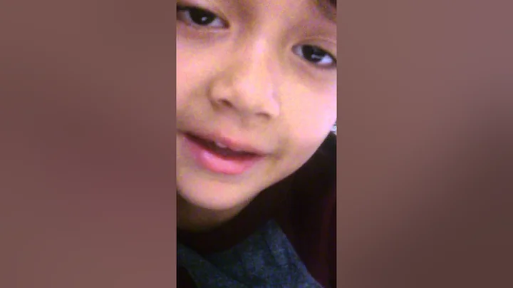 Jayden delirious from dentist visit