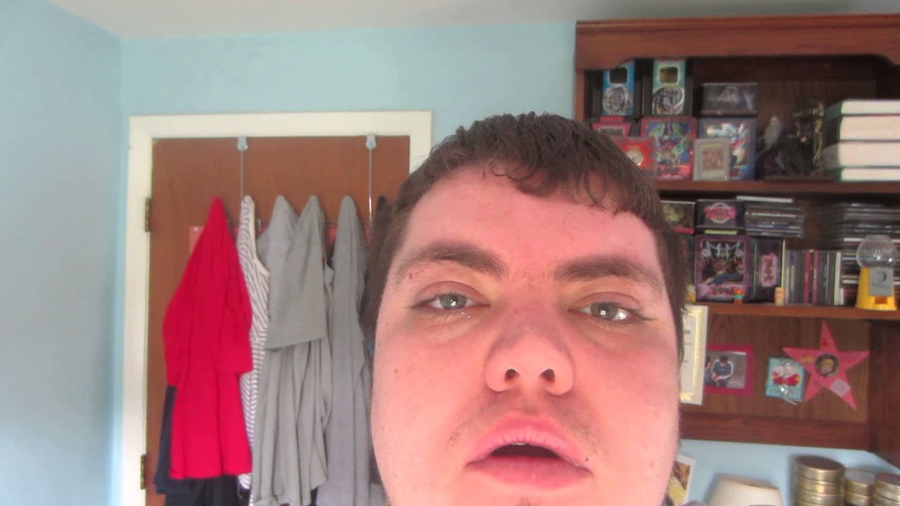 My Teeth After Over 6 Years Of Pipe/Cigar Smoking YouTube