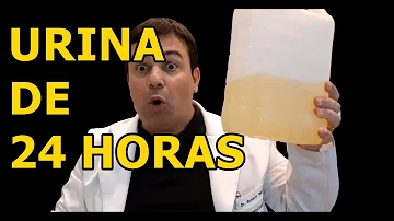 Como é realizado o exame de Microalbuminuria?