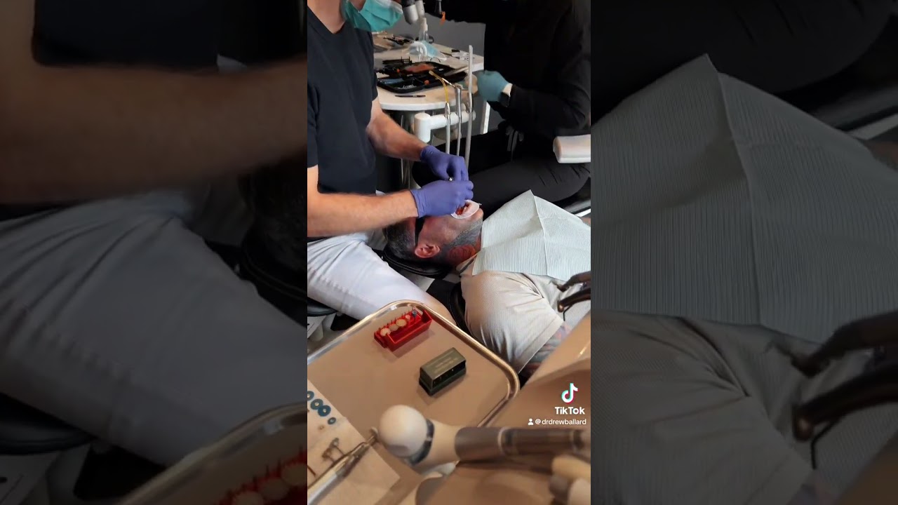 HALO NON INAVSIVE DENTAL VENEERS IN PHOENIX ARIZONA